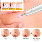 🔥  LAPIZ CAUTERIZADOR DE VERRUGAS SIN DOLOR + ENVIO GRATIS!